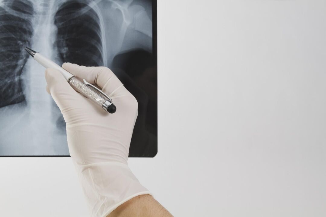 X-ray alang sa pagdayagnos sa osteochondrosis