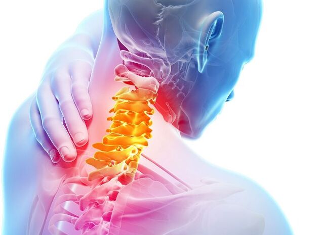 Mga simtomas ug mga yugto sa pag-uswag sa cervical osteochondrosis