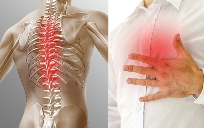 Ang thoracic osteochondrosis gipakita sa kasakit ug usa ka pagbati sa kahugot sa dughan