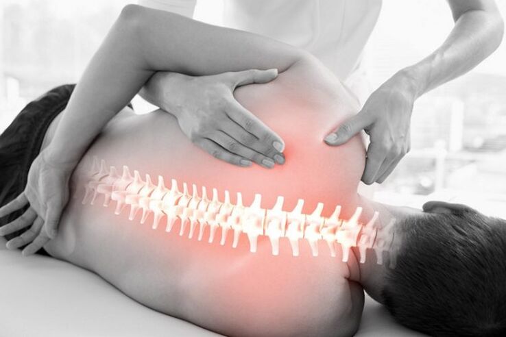 Manual therapy session alang sa osteochondrosis sa thoracic spine